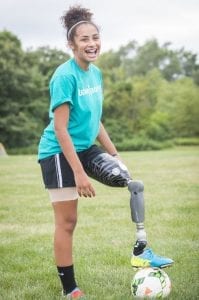 lower limb prosthetics