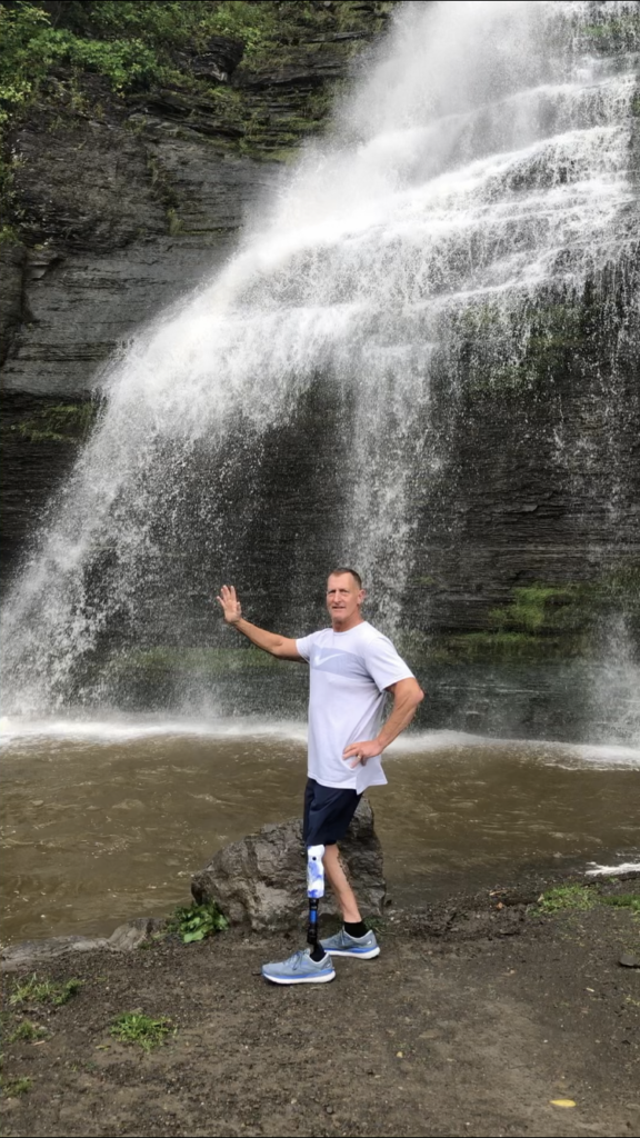 – Prosthetic Fitting Success Stories