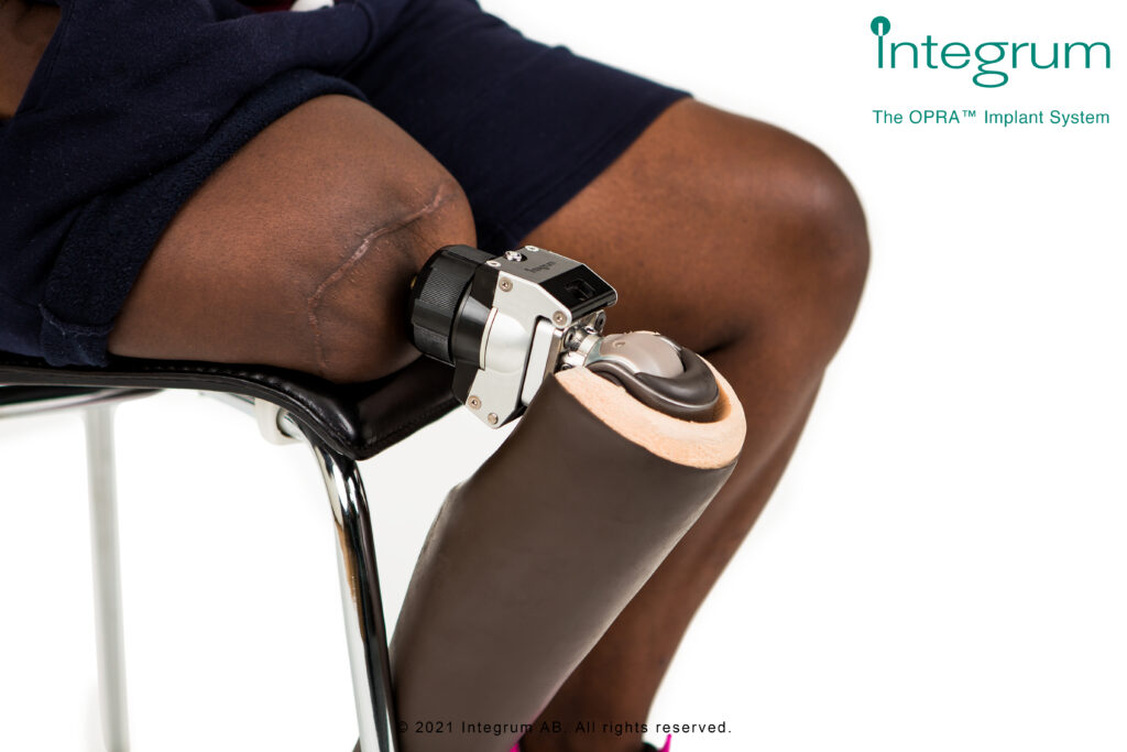 Osseointegration-integrum-2
