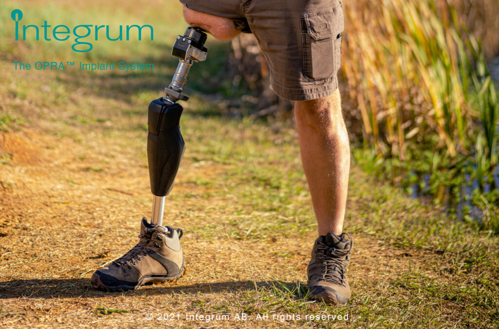 Osseointegration-integrum