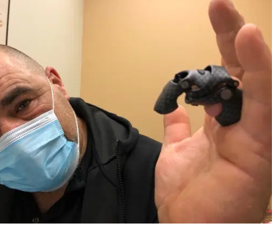 types of prosthetic limbs 2
